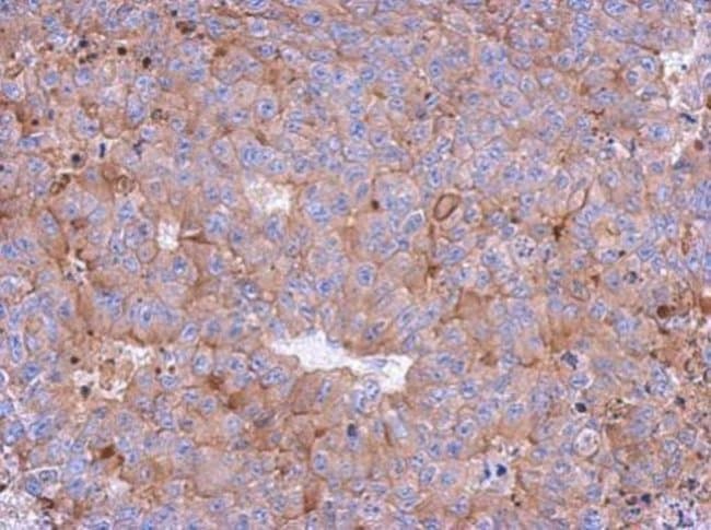 Anti-Calpain 1