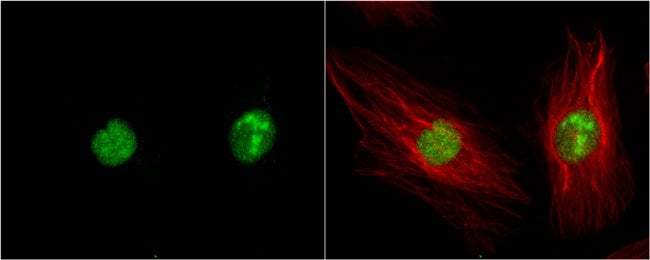 Anti-DAP kinase 3