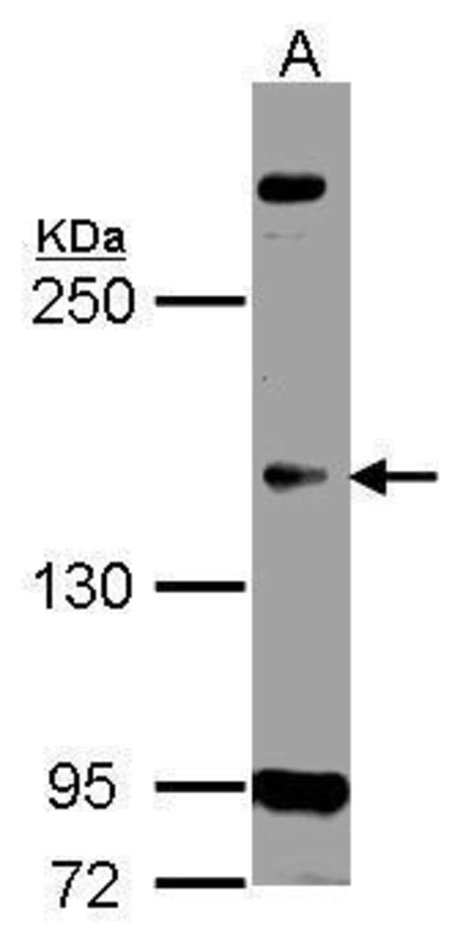 Anti-CDC2L5