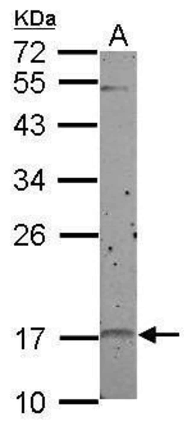 Anti-p19 INK4d