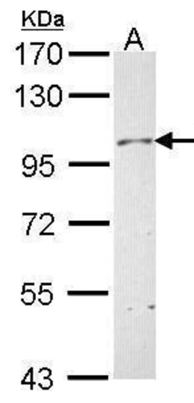 Anti-Neuropilin 1