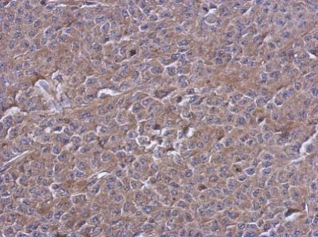 Anti-PTPN12