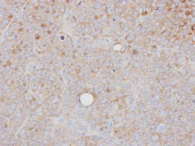 Anti-PRPS1