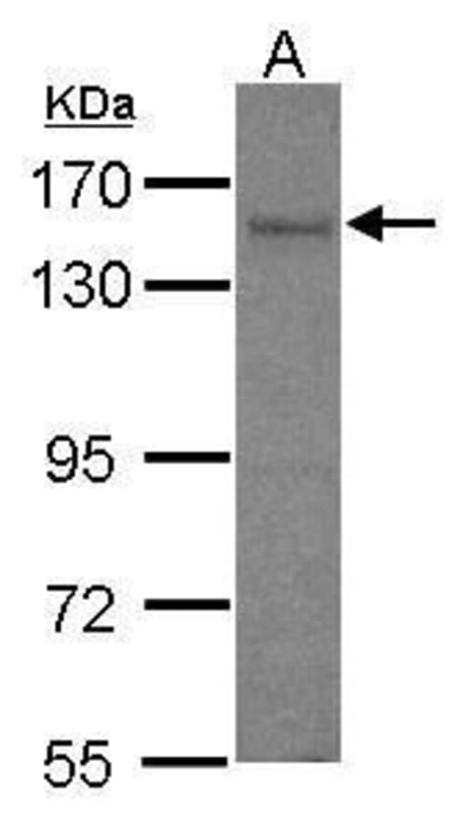 Anti-AKAP1