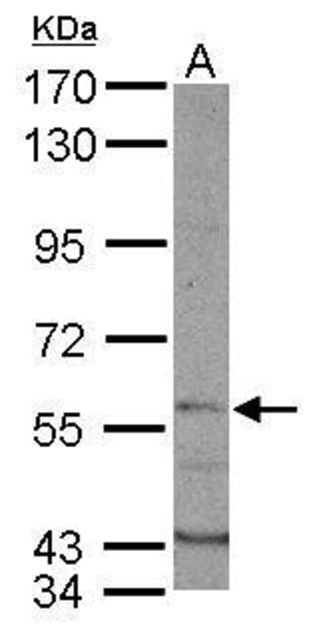 Anti-DYRK1B