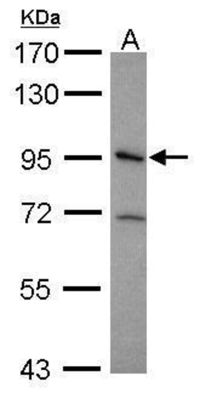 Anti-Integrin beta 5