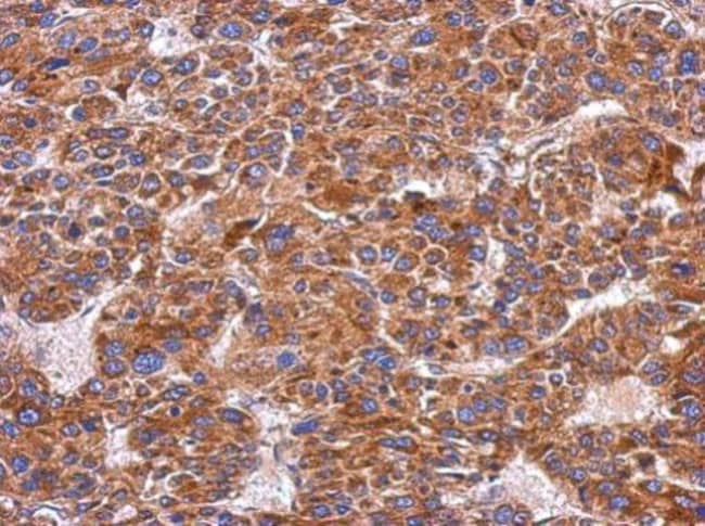 Anti-Integrin alpha 9