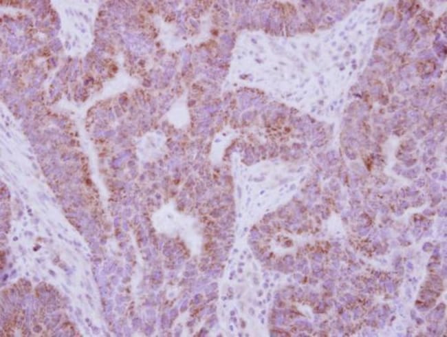 Anti-IL10 Receptor alpha
