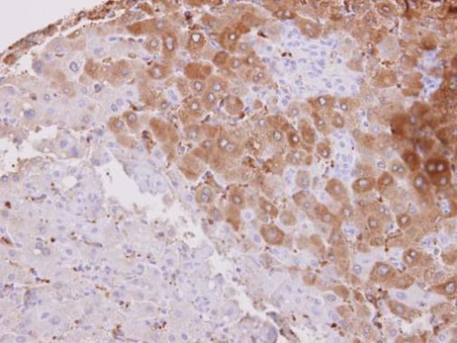 Anti-HSD3B2