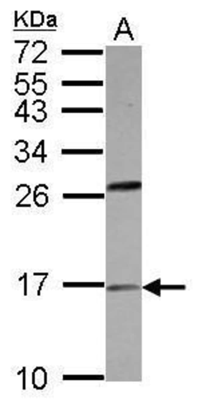 Anti-PLA2G1B