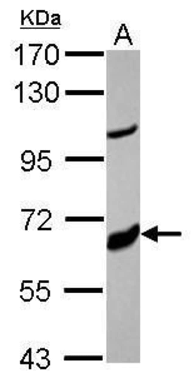 Anti-CYP17A1