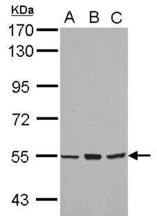 Anti-CYP4B1