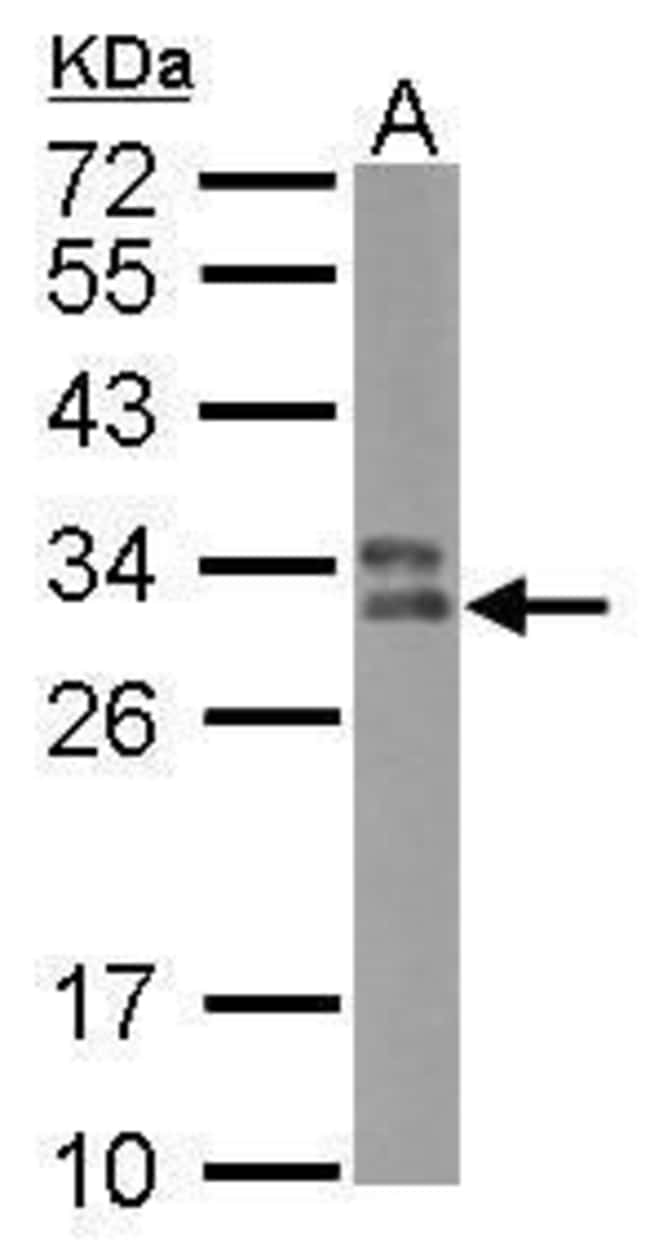 Anti-HLA-DPB1