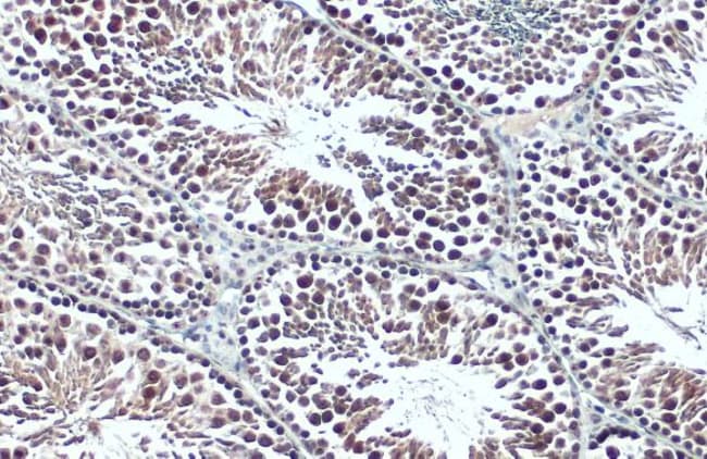 Anti-BRPF1