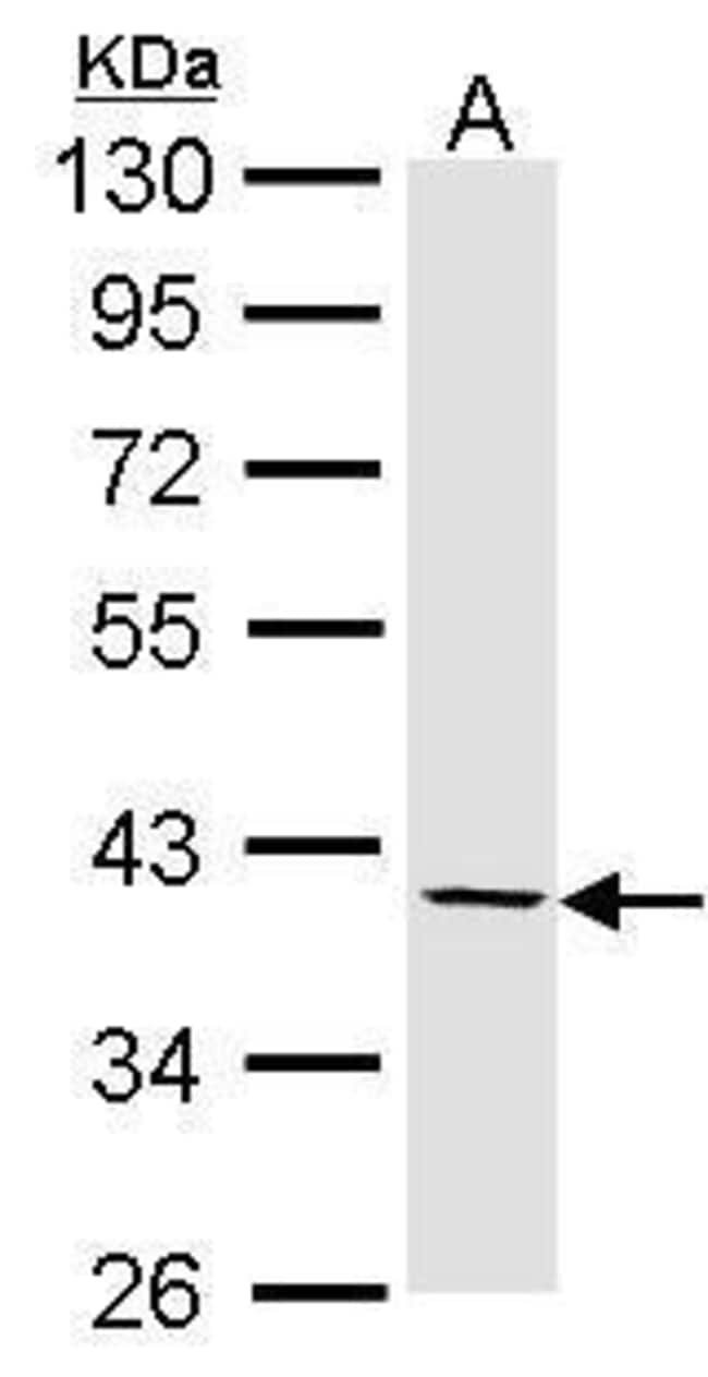 Anti-Fibromodulin