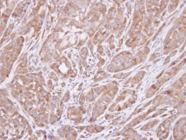 Anti-HSD3B2