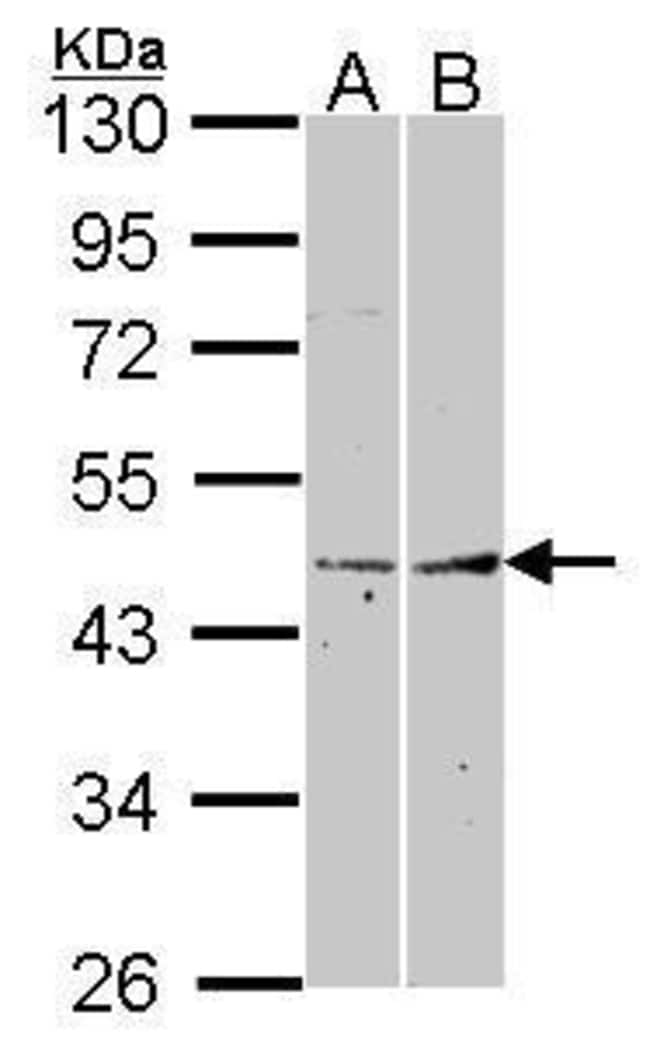 Anti-Fibromodulin