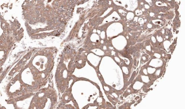 Anti-MMP12