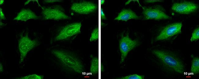 Anti-Aconitase 1