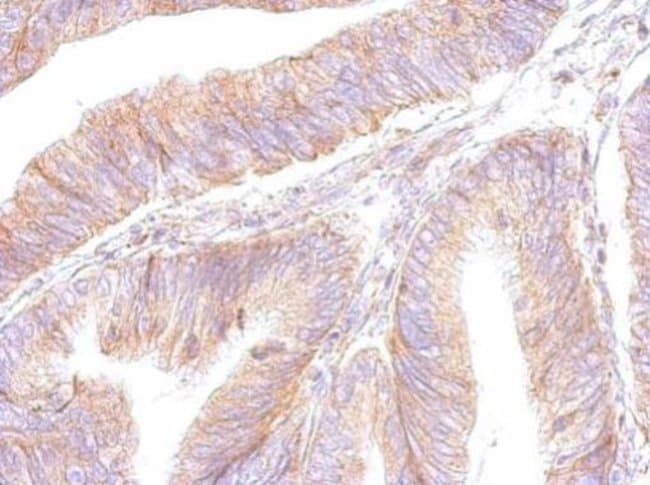 Anti-ATP synthase B1