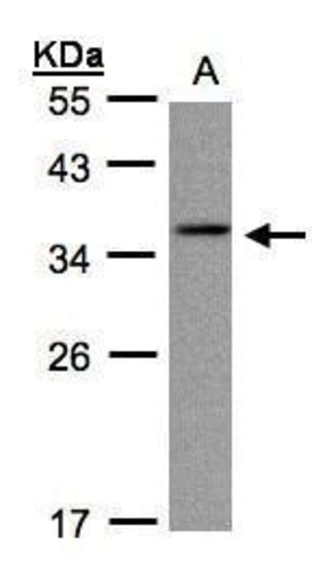 Anti-gamma C Crystallin