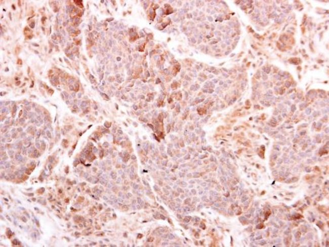 Anti-MDA5