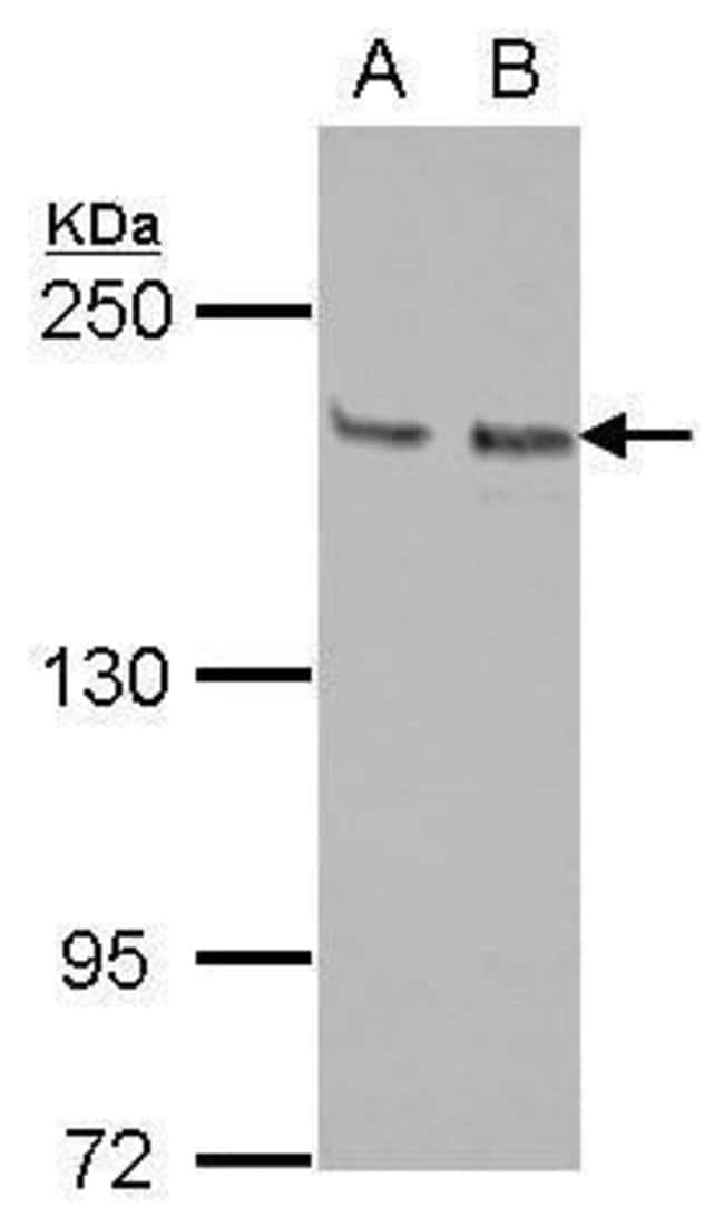 Anti-KIF14
