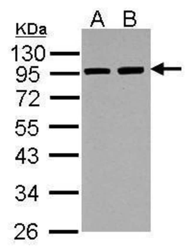 Anti-alpha Actinin 3