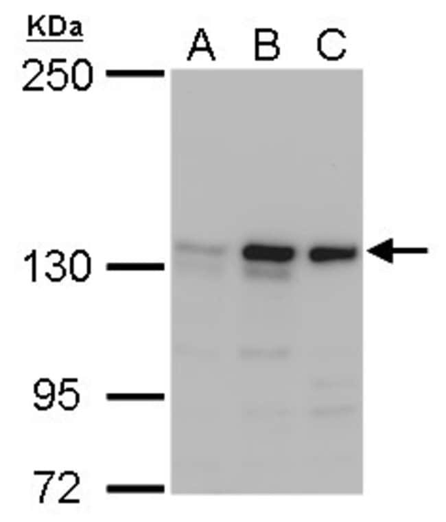 Anti-MSH3