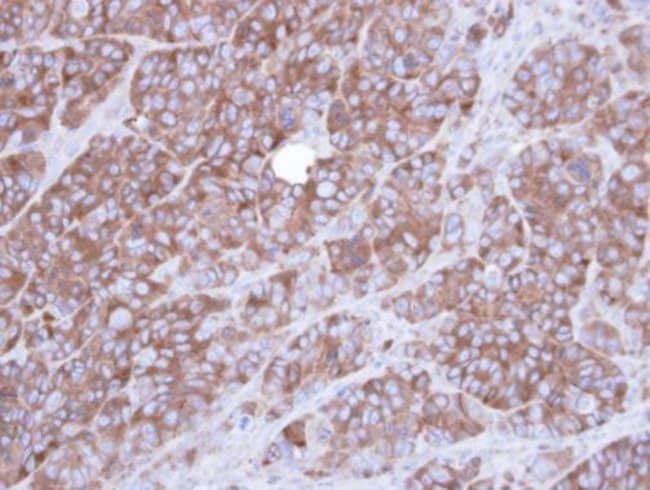 Anti-alpha Actinin 1