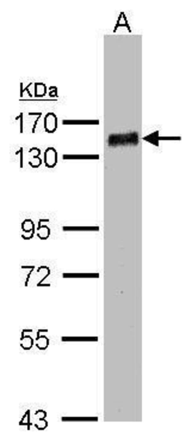 Anti-PHD finger protein 20