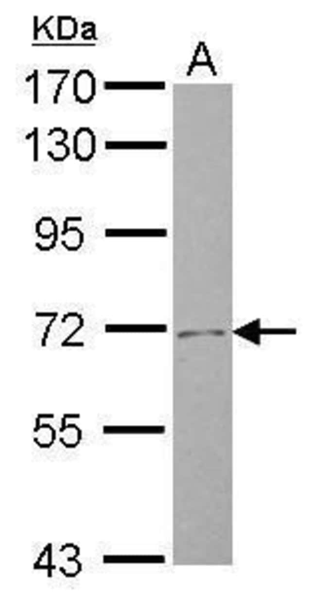 Anti-SLC4A8