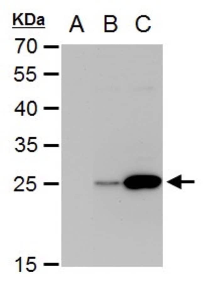 Anti-NS4B (Dengue virus 2)