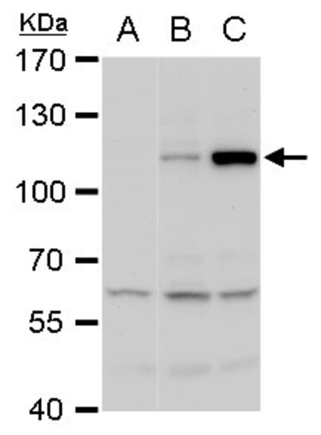 Anti-NS5 (Dengue virus 2)