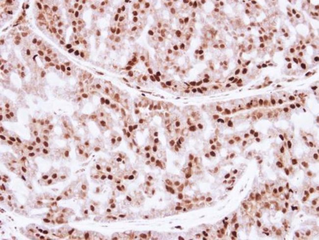 Anti-ZNF323