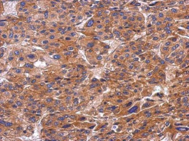 Anti-SNX9