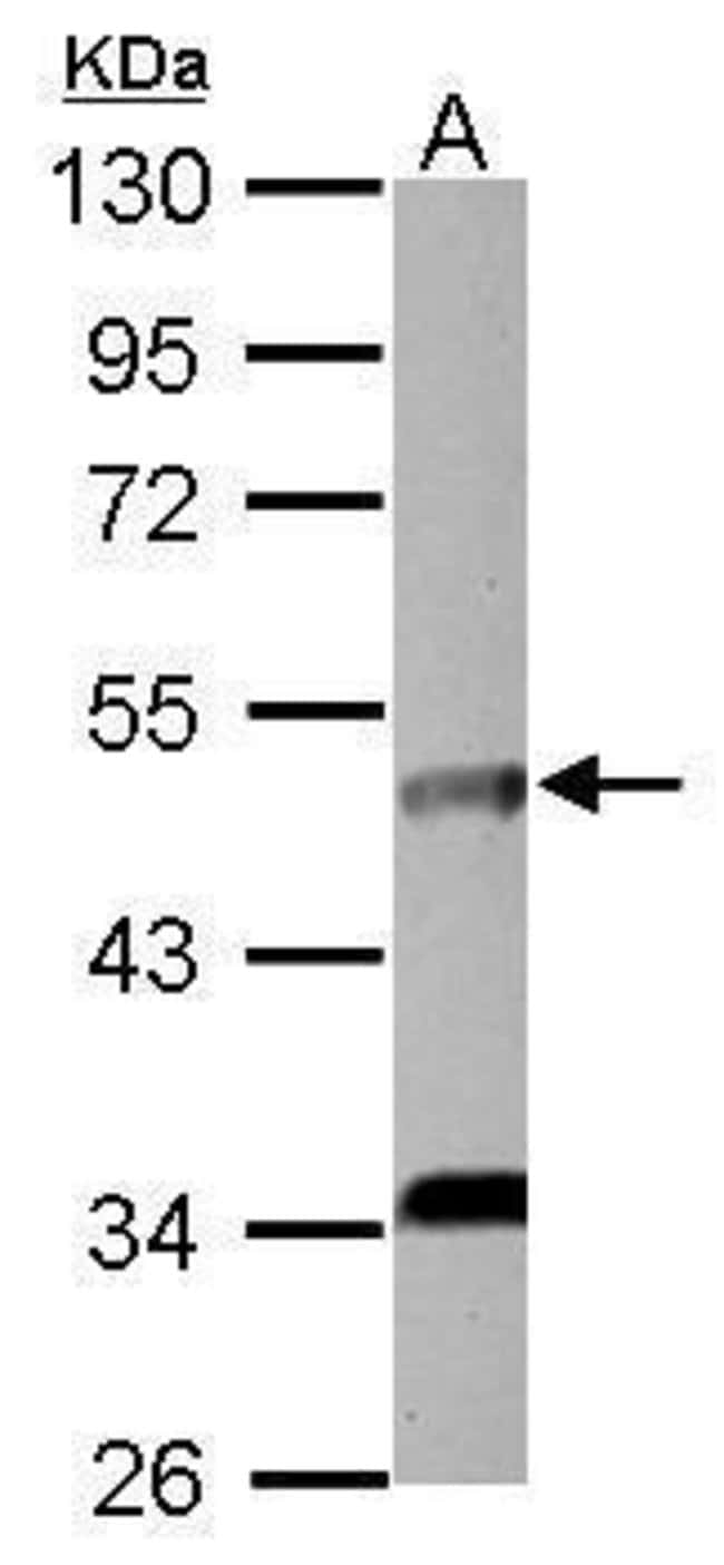 Anti-IL5 Receptor alpha