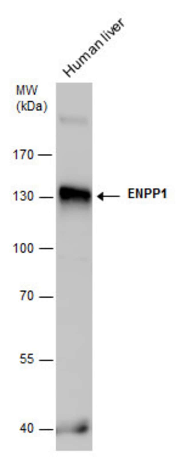 Anti-ENPP1
