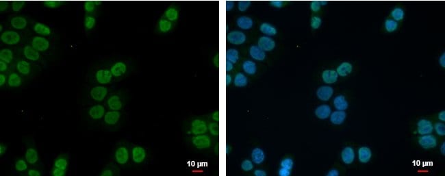 Anti-zinc finger protein 45