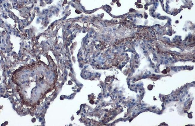 Anti-Vitronectin