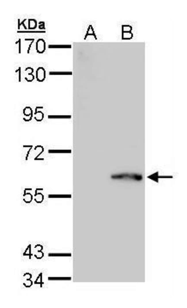 ANTI-FOLYLPOLYGLUTAMATE SYNTHASE