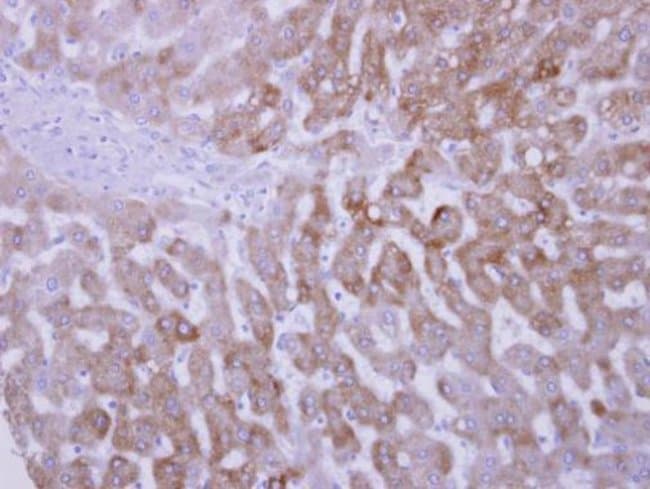 Anti-FMO3