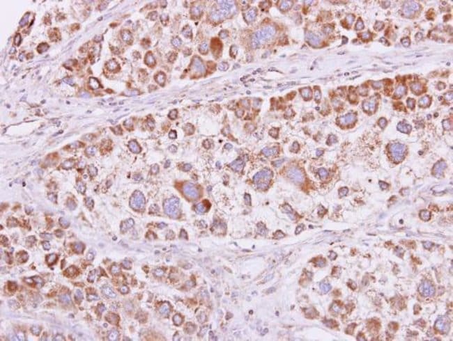 Anti-PSKH1