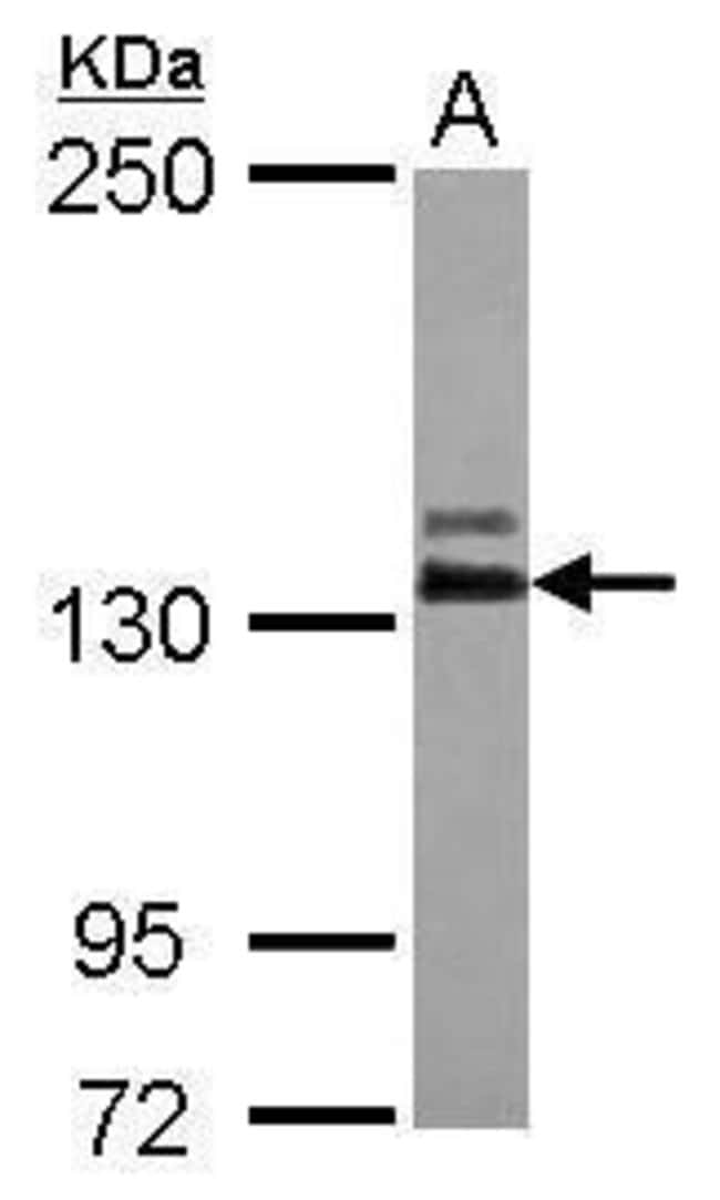 Anti-ABL2