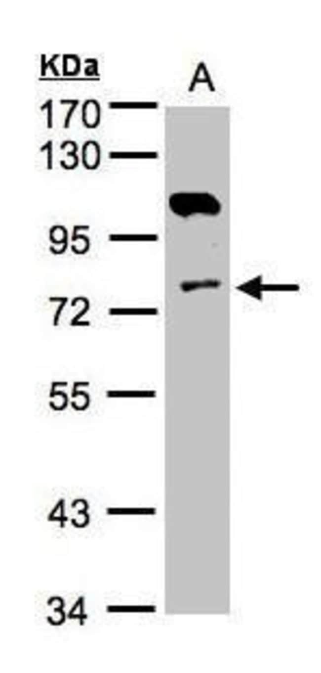 Anti-Adenylate kinase 7