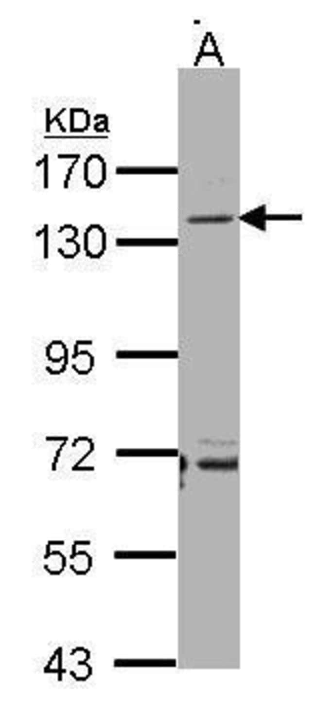 Anti-CD22