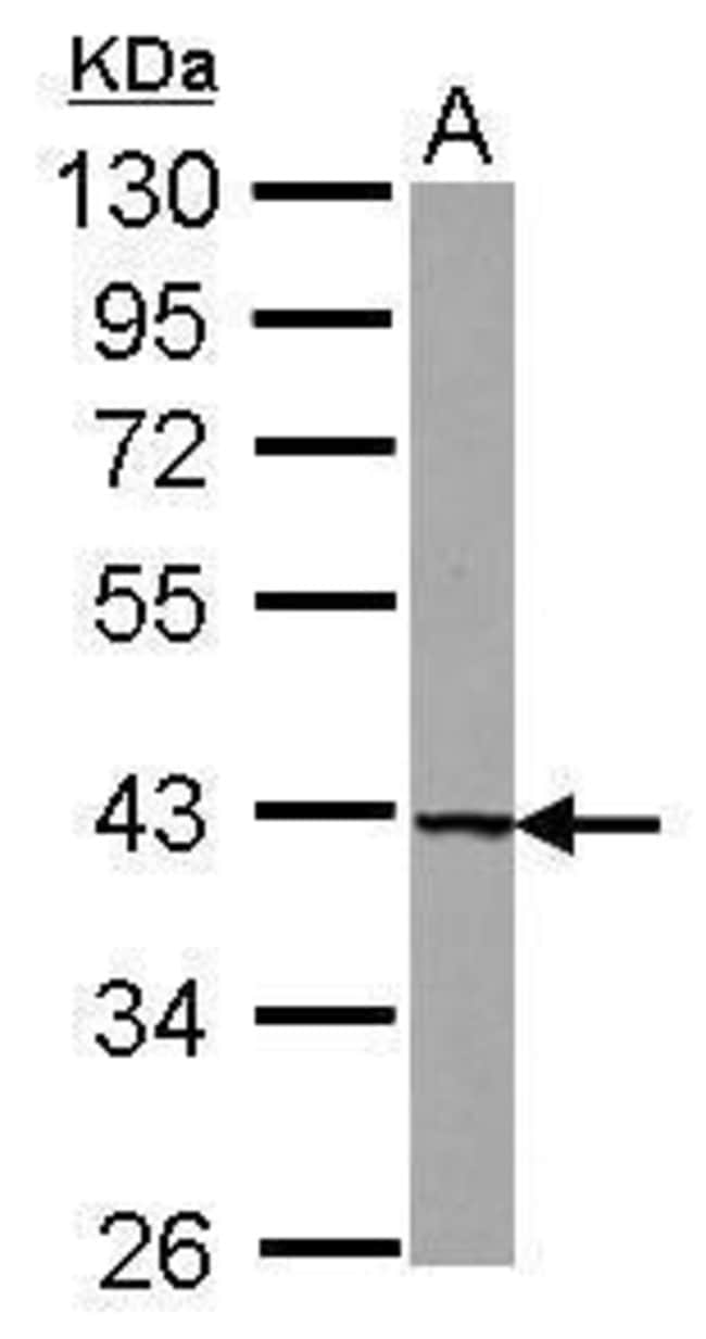 Anti-UROD