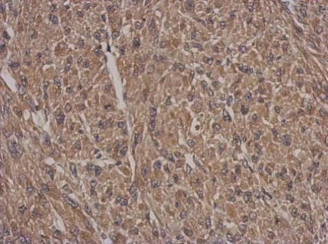 Anti-HSF2BP
