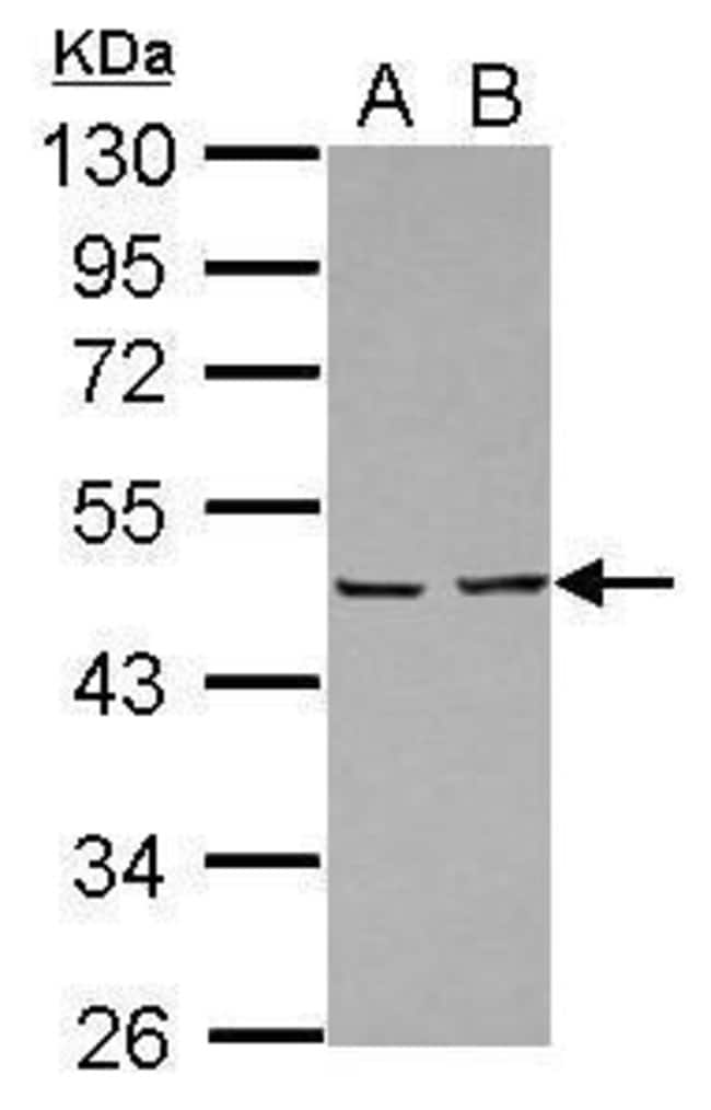 Anti-EBP1