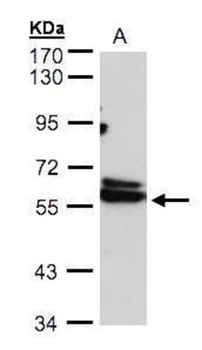 Anti-TCP-1 delta